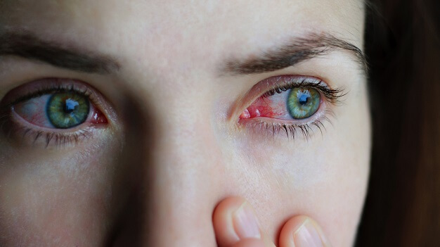 10 причин покраснения глаз от клиники World Vision.