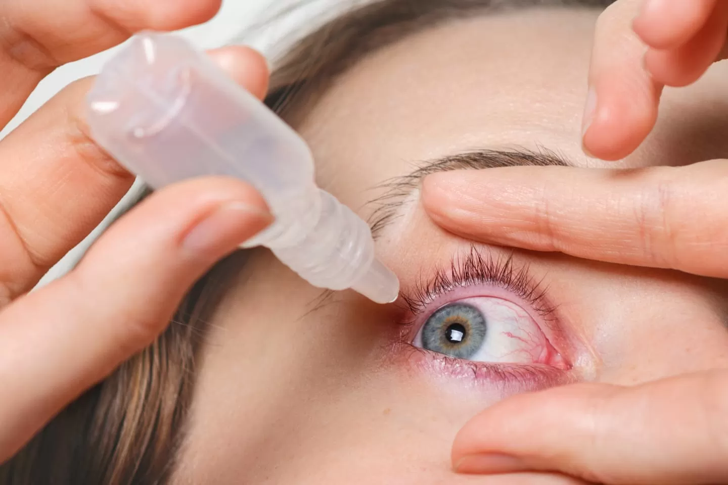 Синдром сухого глаза – бич 21 века